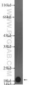 Myosin regulatory light chain 2, ventricular/cardiac muscle isoform antibody, 55462-1-AP, Proteintech Group, Western Blot image 