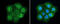 Translocated Promoter Region, Nuclear Basket Protein antibody, GTX130142, GeneTex, Immunofluorescence image 