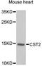 Cystatin-SA antibody, STJ28654, St John