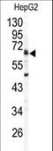 Arylsulfatase B antibody, LS-C100667, Lifespan Biosciences, Western Blot image 