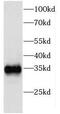 Eukaryotic Translation Initiation Factor 2B Subunit Alpha antibody, FNab02693, FineTest, Western Blot image 