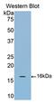 Cartilage Oligomeric Matrix Protein antibody, LS-C700158, Lifespan Biosciences, Western Blot image 