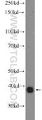 Eukaryotic Translation Initiation Factor 2B Subunit Beta antibody, 11034-1-AP, Proteintech Group, Western Blot image 