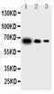 Interleukin 23 Subunit Alpha antibody, GTX11715, GeneTex, Western Blot image 