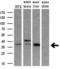 Homeobox C11 antibody, M08258, Boster Biological Technology, Western Blot image 