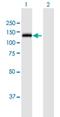 O-GlcNAcase antibody, H00010724-B01P, Novus Biologicals, Western Blot image 