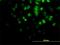 AKT Serine/Threonine Kinase 2 antibody, H00000208-M05, Novus Biologicals, Immunofluorescence image 