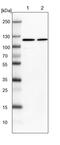 FES Proto-Oncogene, Tyrosine Kinase antibody, PA5-51568, Invitrogen Antibodies, Western Blot image 