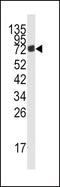 AMP deaminase 3 antibody, PA5-15032, Invitrogen Antibodies, Western Blot image 