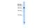 Trinucleotide Repeat Containing Adaptor 6B antibody, A06528, Boster Biological Technology, Western Blot image 