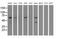 Epoxide Hydrolase 2 antibody, MA5-25222, Invitrogen Antibodies, Western Blot image 