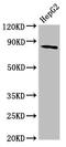 MTSS I-BAR Domain Containing 1 antibody, CSB-PA015201LA01HU, Cusabio, Western Blot image 