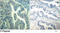 Cyclin Dependent Kinase 6 antibody, LS-C203609, Lifespan Biosciences, Immunohistochemistry paraffin image 