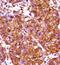 Iroquois Homeobox 3 antibody, GTX53650, GeneTex, Immunohistochemistry paraffin image 