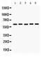 Monoamine Oxidase A antibody, PA5-79623, Invitrogen Antibodies, Western Blot image 