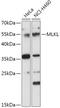Mixed lineage kinase domain-like protein antibody, 16-911, ProSci, Western Blot image 