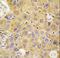 Alanyl-TRNA Synthetase antibody, LS-C100176, Lifespan Biosciences, Immunohistochemistry paraffin image 