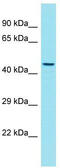 G Protein-Coupled Receptor 180 antibody, TA337330, Origene, Western Blot image 