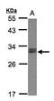 NSE1 Homolog, SMC5-SMC6 Complex Component antibody, TA308558, Origene, Western Blot image 