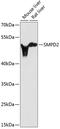 Sphingomyelin Phosphodiesterase 2 antibody, 14-088, ProSci, Western Blot image 