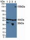 Hypoxia Inducible Factor 1 Subunit Alpha Inhibitor antibody, abx129020, Abbexa, Western Blot image 