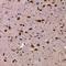 Metadherin antibody, LS-C668963, Lifespan Biosciences, Immunohistochemistry paraffin image 