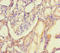 DNA Methyltransferase 3 Beta antibody, LS-C682175, Lifespan Biosciences, Immunohistochemistry paraffin image 