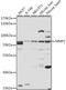 Matrix Metallopeptidase 2 antibody, LS-C746891, Lifespan Biosciences, Western Blot image 