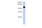 Putative ciliary rootlet coiled-coil protein-like 2 protein antibody, PA5-69787, Invitrogen Antibodies, Western Blot image 