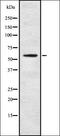 CO9A2 antibody, orb337701, Biorbyt, Western Blot image 