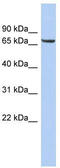 Leucine Rich Repeat Transmembrane Neuronal 4 antibody, TA338692, Origene, Western Blot image 