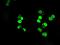 SATB Homeobox 1 antibody, MA5-24961, Invitrogen Antibodies, Immunocytochemistry image 