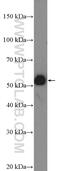 Homeobox A10 antibody, 26497-1-AP, Proteintech Group, Western Blot image 