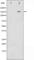 Platelet Derived Growth Factor Receptor Beta antibody, abx011959, Abbexa, Western Blot image 
