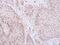 General Transcription Factor IIE Subunit 2 antibody, NBP1-32717, Novus Biologicals, Immunohistochemistry frozen image 