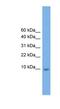 Keratin Associated Protein 23-1 antibody, NBP1-70596, Novus Biologicals, Western Blot image 