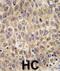 Alpha Fetoprotein antibody, abx027957, Abbexa, Immunohistochemistry paraffin image 