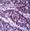 Oxoglutarate Dehydrogenase antibody, LS-C163111, Lifespan Biosciences, Immunohistochemistry paraffin image 