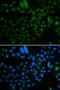 AlkB Homolog 8, TRNA Methyltransferase antibody, LS-C346248, Lifespan Biosciences, Immunofluorescence image 