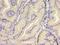 Gelsolin antibody, LS-C369741, Lifespan Biosciences, Immunohistochemistry paraffin image 