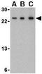 Thymic Stromal Lymphopoietin antibody, GTX85059, GeneTex, Western Blot image 