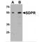 Caveolae Associated Protein 1 antibody, MBS153486, MyBioSource, Western Blot image 