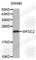 WAP Four-Disulfide Core Domain 2 antibody, A5582, ABclonal Technology, Western Blot image 