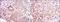 Mitogen-Activated Protein Kinase Kinase 6 antibody, NBP2-37637, Novus Biologicals, Immunohistochemistry paraffin image 