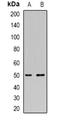 Thymidine Phosphorylase antibody, orb382100, Biorbyt, Western Blot image 