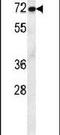 Activating Transcription Factor 7 Interacting Protein 2 antibody, PA5-24011, Invitrogen Antibodies, Western Blot image 