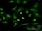 T Cell Receptor Gamma Variable 3 antibody, H00006976-B01P, Novus Biologicals, Immunocytochemistry image 