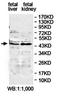 Ethanolamine kinase 2 antibody, orb78367, Biorbyt, Western Blot image 