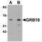 Growth Factor Receptor Bound Protein 10 antibody, MBS150671, MyBioSource, Western Blot image 