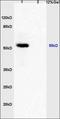 Calcium/Calmodulin Dependent Protein Kinase IV antibody, orb101719, Biorbyt, Western Blot image 